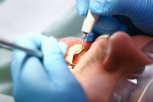 Best Emergency Dental Care for Abscessed Tooth in Terrell, TX