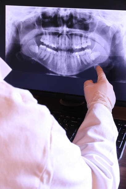 Best Emergency Root Canal Treatment in Terrell, TX